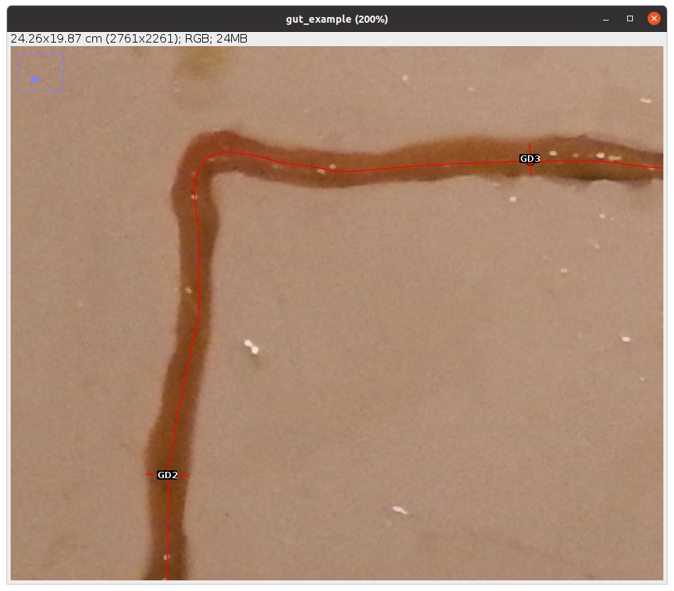 Example of intestinal diameter